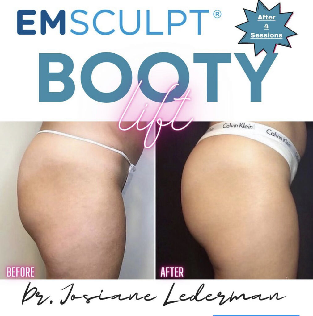 What's the Difference Between EMSCULPT NEO® and CoolSculpting®? Staten  Island, NY - Still Well Med Spa