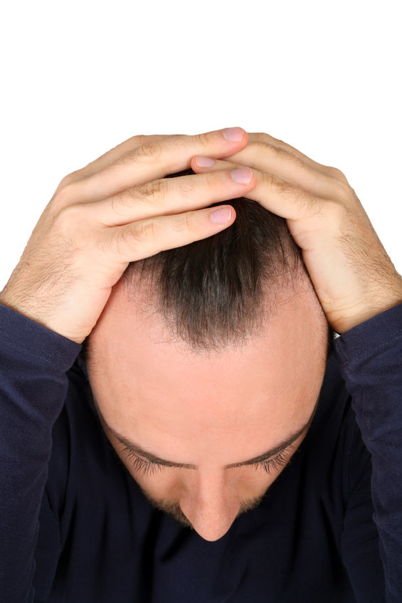 Hair Loss Treatment Staten Island medical scalp evaluation by Dr Lederman